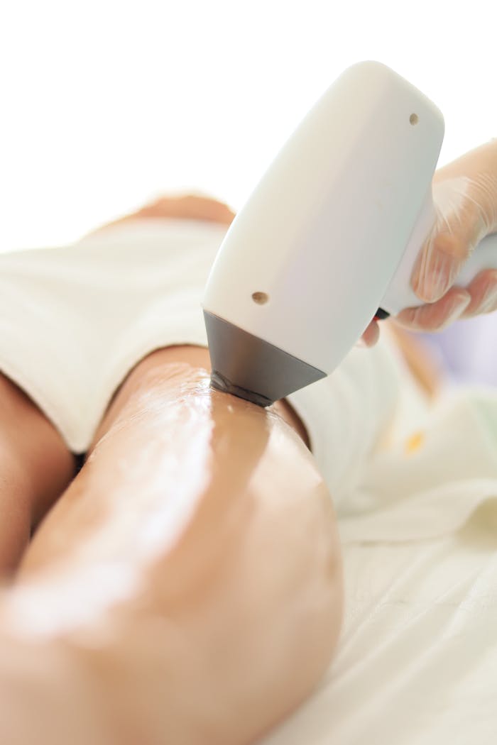 Close-up of laser hair removal on womans leg in professional spa setting.